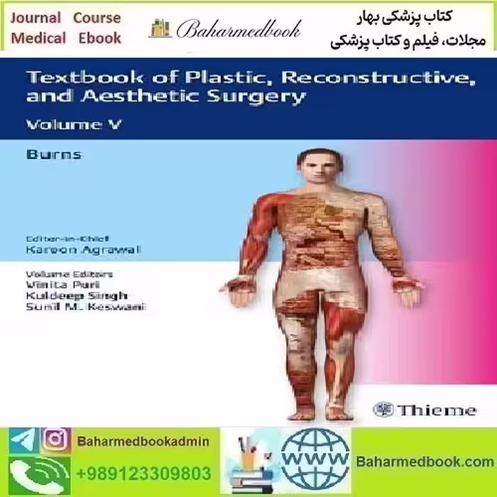Textbook of Plastic Reconstructive and Aesthetic Surgery Burns