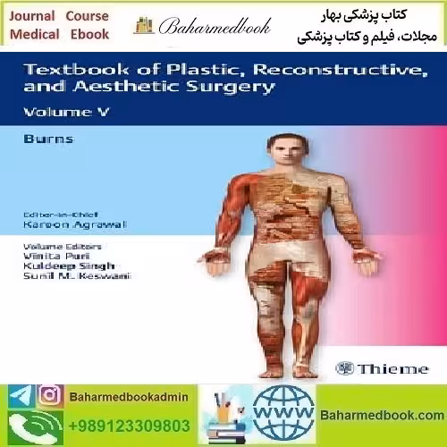Textbook of Plastic Reconstructive and Aesthetic Surgery Burns