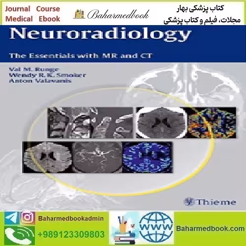 Neuroradiology The Essentials with MR and CT With Neuroradiol