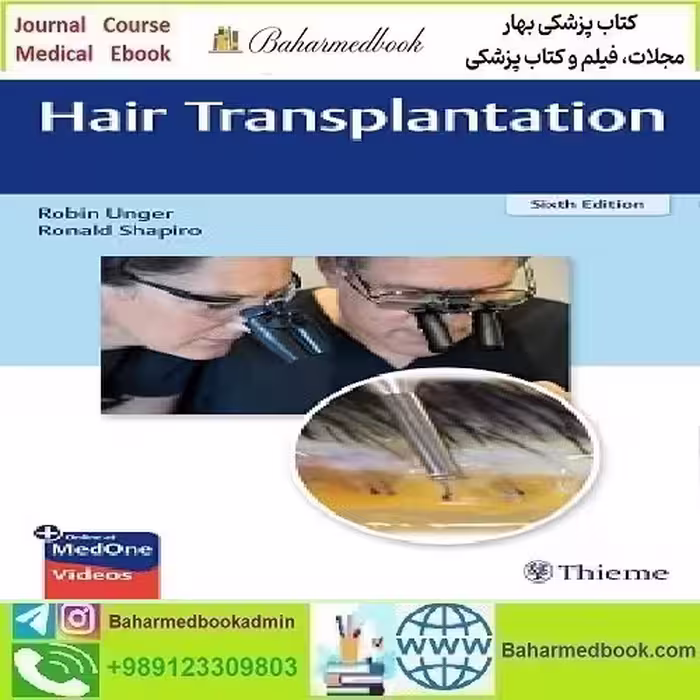 Hair Transplantation 2023 TRUE PDF price 2€ - کتاب پزشکی بهار