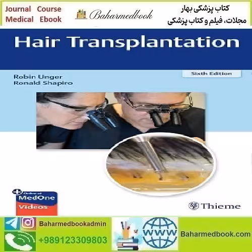 Hair Transplantation 2023 TRUE PDF price 2€ - کتاب پزشکی بهار