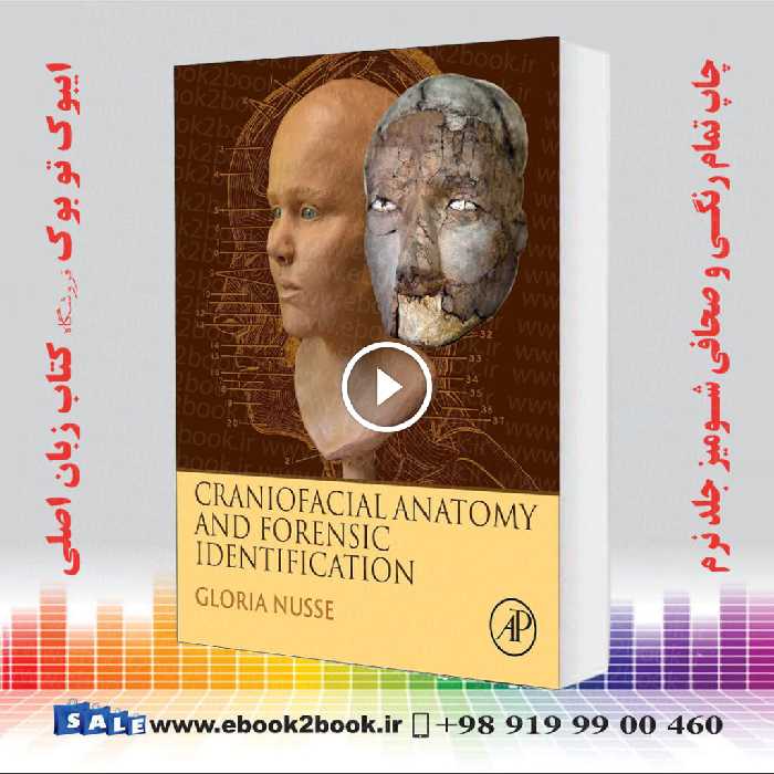 Craniofacial Anatomy and Forensic Identification