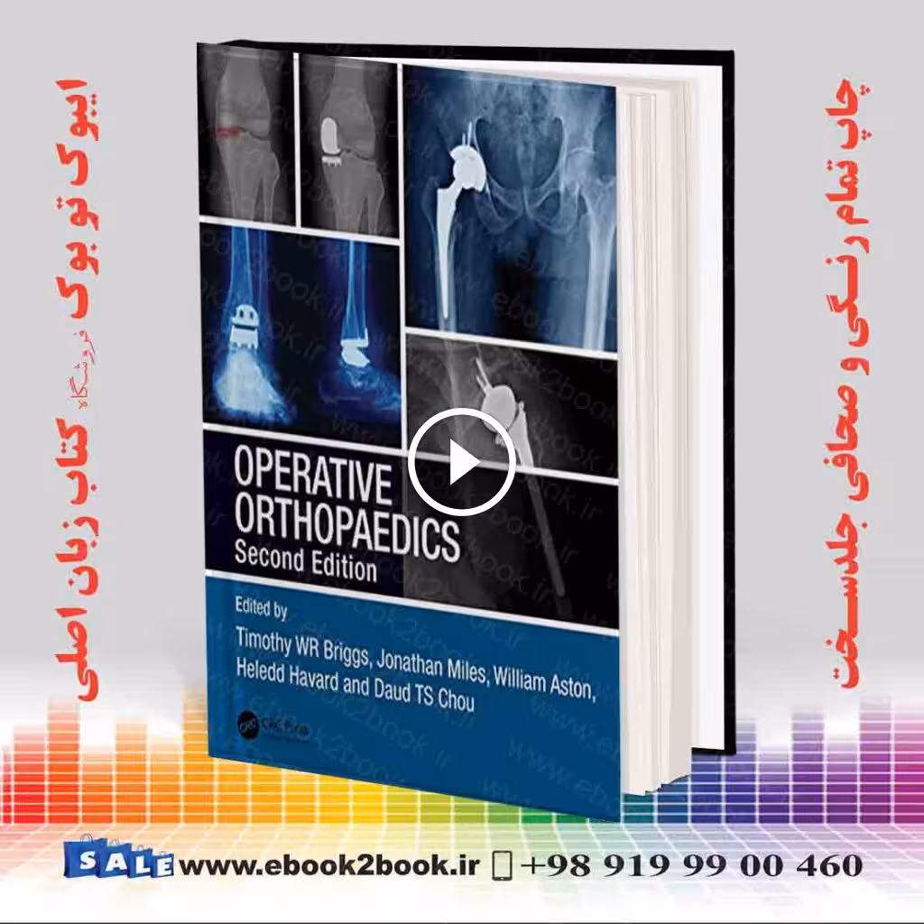 Operative Orthopaedics 2nd Edition