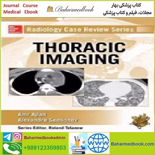 Radiology Case Review Series Thoracic Imaging TRUE PDF pri