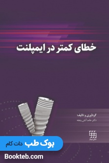 خطای کمتر در ایمپلنت