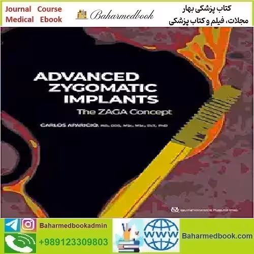 Advanced Zygomatic Implants The Zaga Concept 2024 TRUE PDF