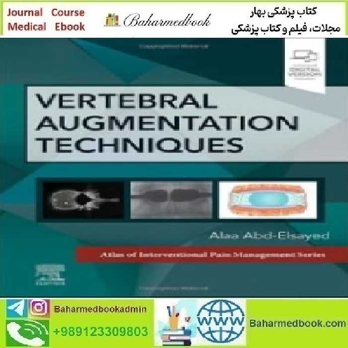 Vertebral Augmentation Techniques 2024 TRUE PDF price 1€ - کتاب پزشکی بهار