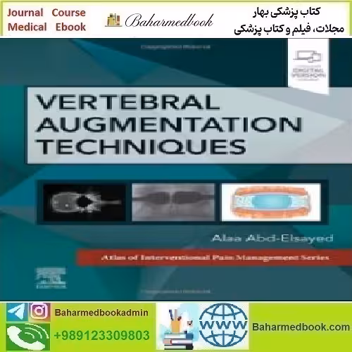 Vertebral Augmentation Techniques 2024 TRUE PDF price 1€ - کتاب پزشکی بهار