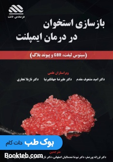 بازسازی استخوان در درمان ایمپلنت