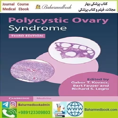 Polycystic Ovary Syndrome 2022 TRUE PDF price 1€ - کتاب پزشکی بهار