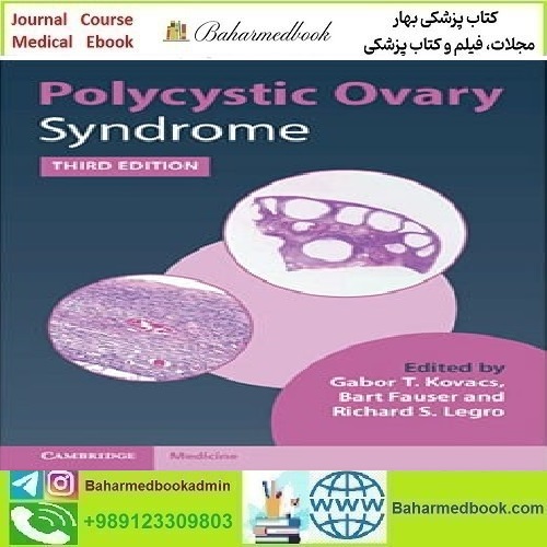 Polycystic Ovary Syndrome 2022 TRUE PDF price 1€ - کتاب پزشکی بهار