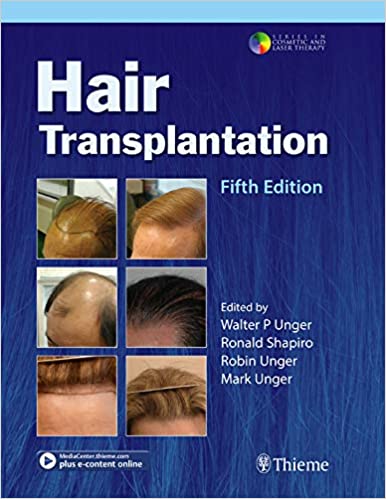 Hair Transplantation - کتاب پزشکی بهار