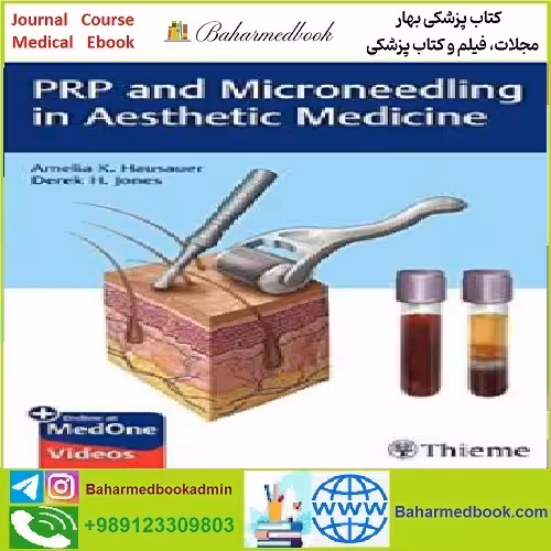 PRP and Microneedling in Aesthetic Medicine TRUE PDF price 1€ - کتاب پزشکی بهار