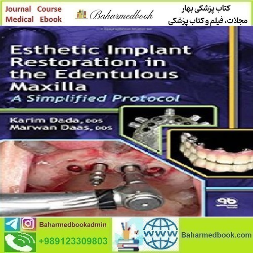 Esthetic Implant Restoration in the Edentulous Maxilla 20