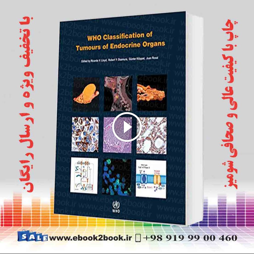 WHO Classification of Tumours of Endocrine Organs 4th Edition