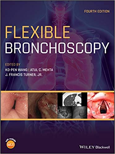  دانلود کتاب Flexible Bronchoscopy, 2020 - دانلود کتاب های دانشگاهی