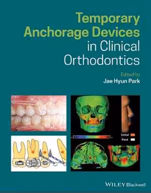 [PDF] دانلود کتاب Temporary Anchorage Devices In Clinical Orthodontics, 2020