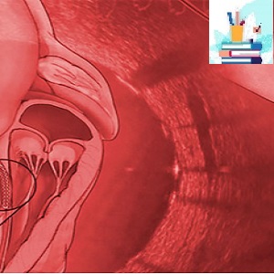 Interventional Cardiology Online Board Review 2020-Videos at 60€ - کتاب پزشکی بهار