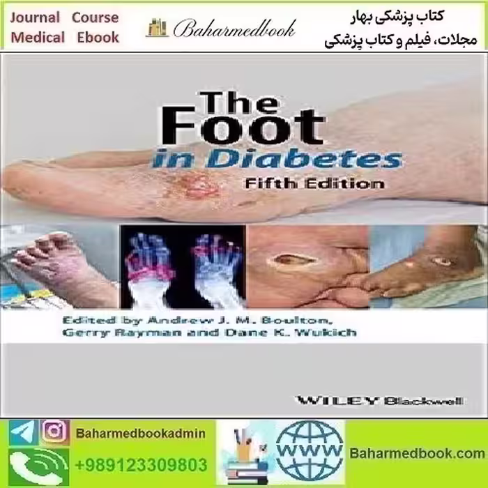 The Foot in Diabetes 2020 TRUE PDF price 1€ - کتاب پزشکی بهار