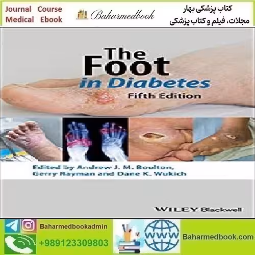 The Foot in Diabetes 2020 TRUE PDF price 1€ - کتاب پزشکی بهار