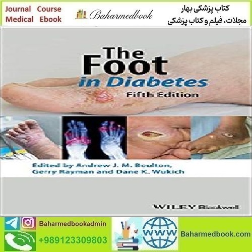 The Foot in Diabetes 2020 TRUE PDF price 1€ - کتاب پزشکی بهار
