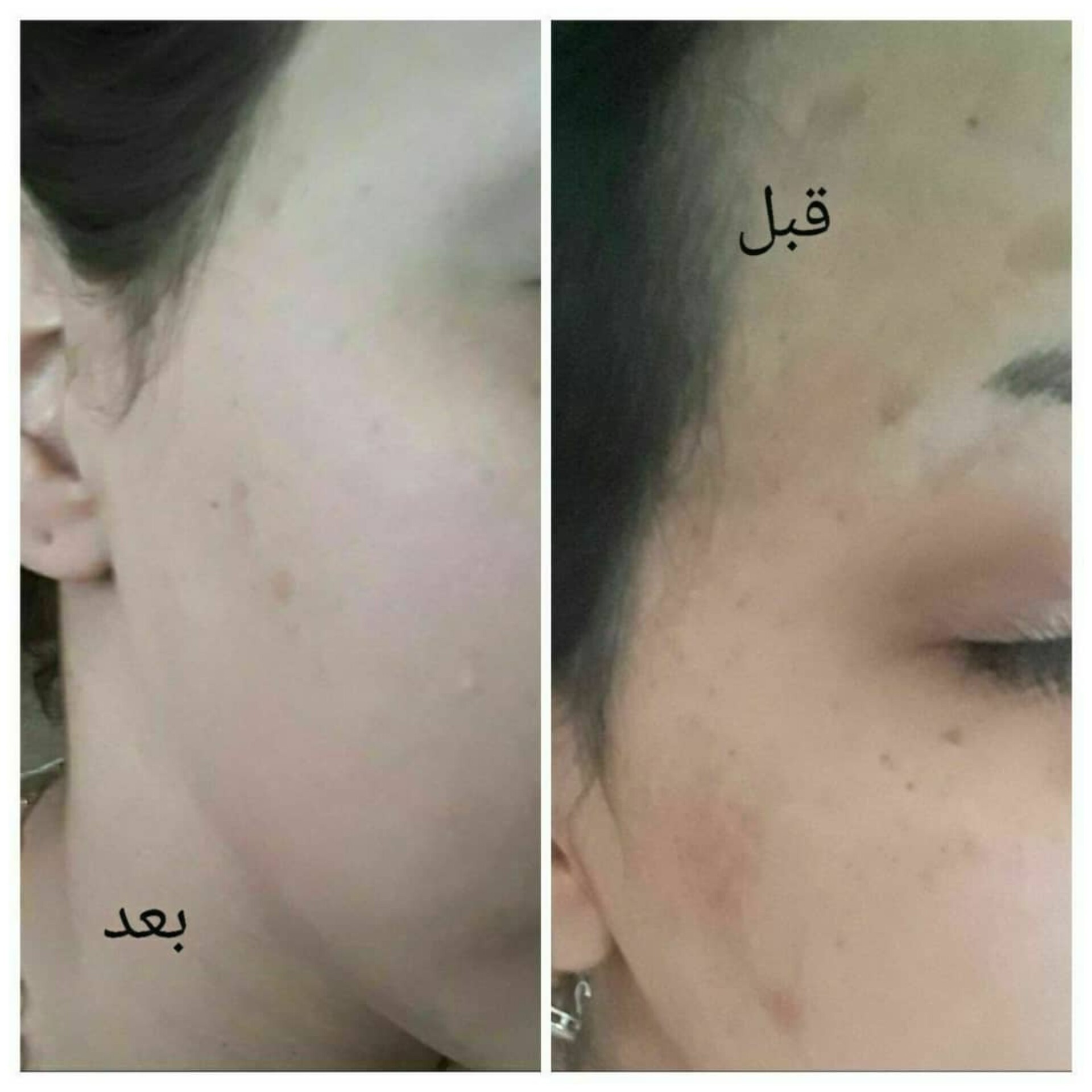 کرم دست و صورت Vip
