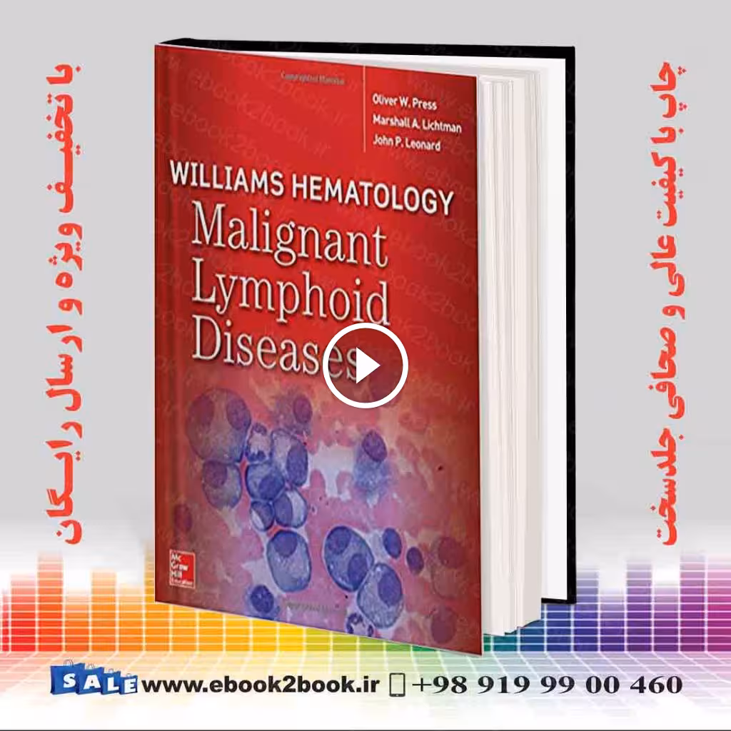 Williams Hematology Malignant Lymphoid Diseases