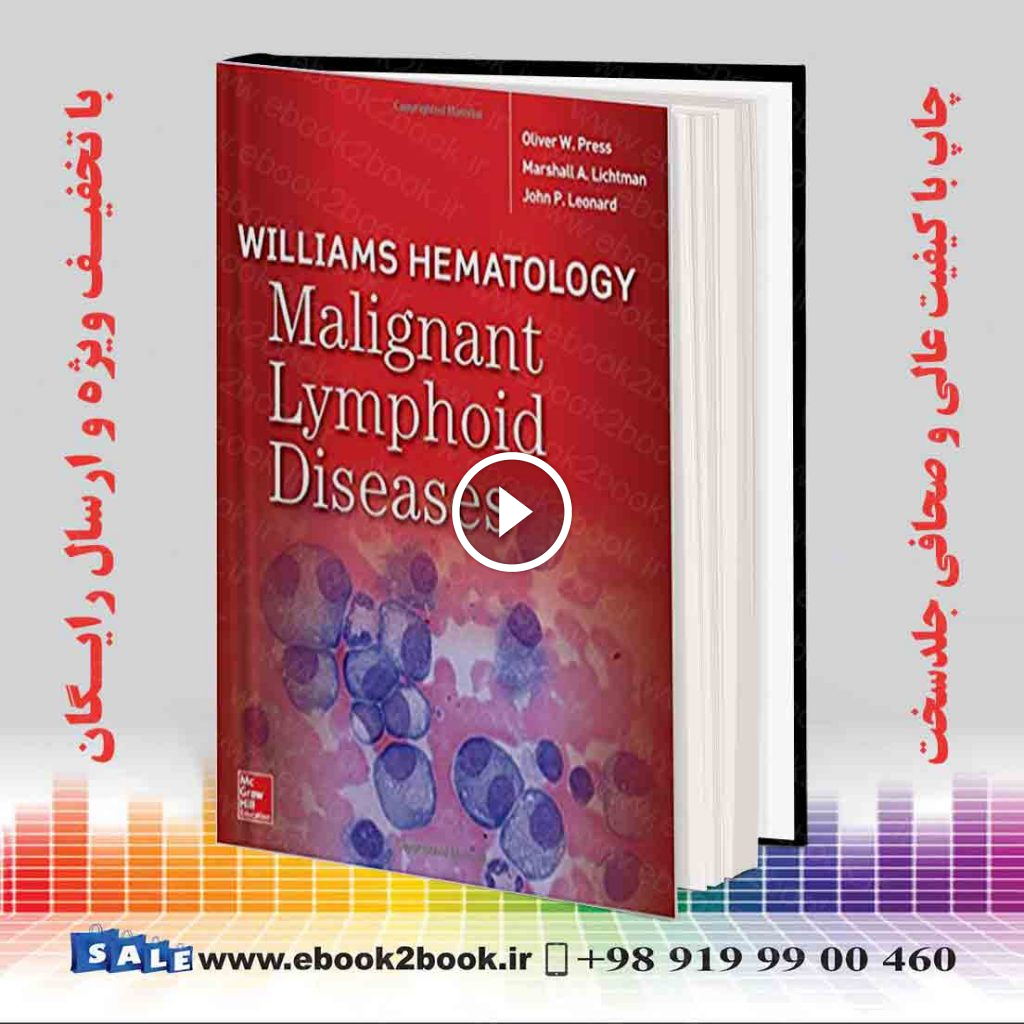 Williams Hematology Malignant Lymphoid Diseases
