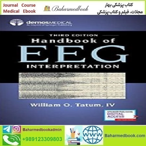 Handbook of EEG Interpretation 2021 TRUE PDF price 1€ - کتاب پزشکی بهار