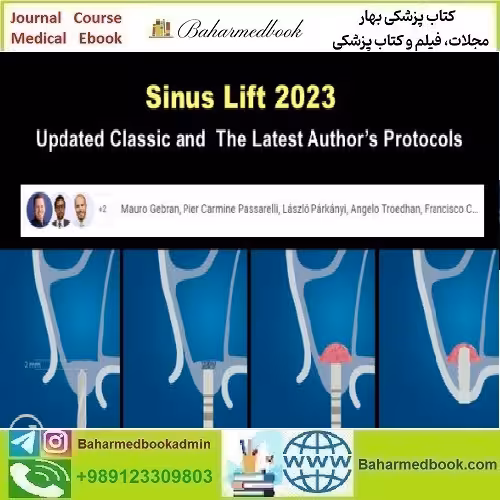 OHI S Sinus Lift 2023 Updated Classic and the Latest Author’s Pr