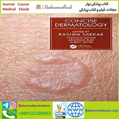 Concise Dermatology TRUE PDF price 1€ - کتاب پزشکی بهار