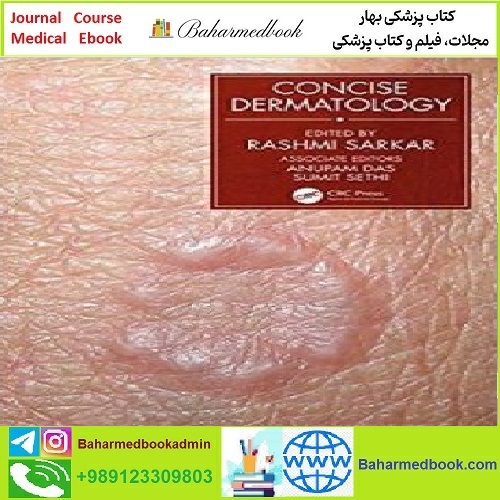 Concise Dermatology TRUE PDF price 1€ - کتاب پزشکی بهار