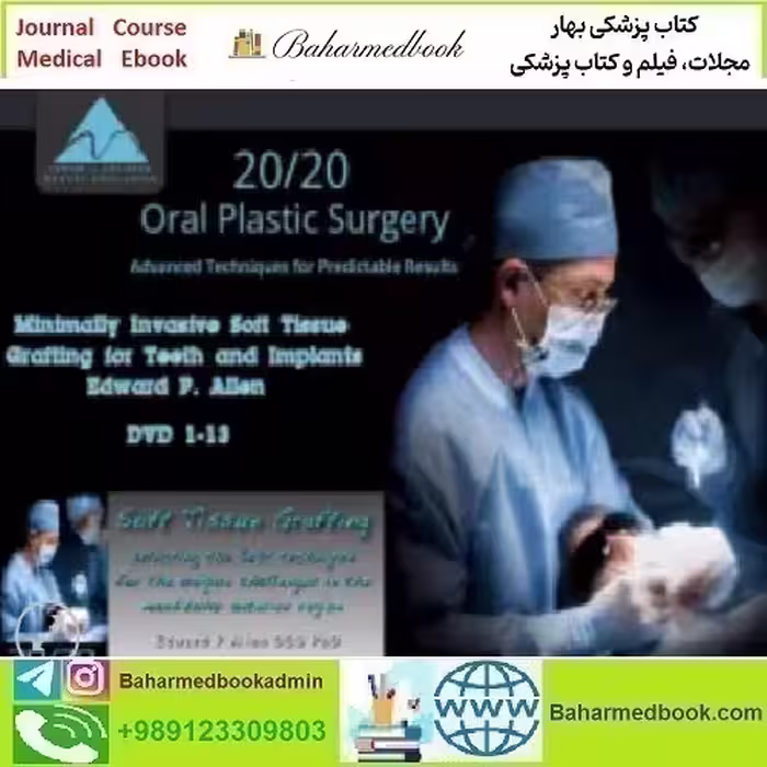 Minimally Invasive Soft Tissue Grafting for Teeth and Implants vid