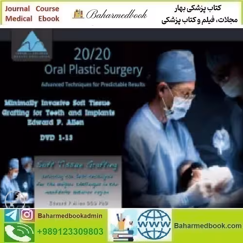 Minimally Invasive Soft Tissue Grafting for Teeth and Implants vid