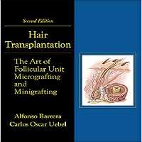 Hair Transplantation: The Art of Micrografting and Minigrafting 2014 - کتاب پزشکی بهار