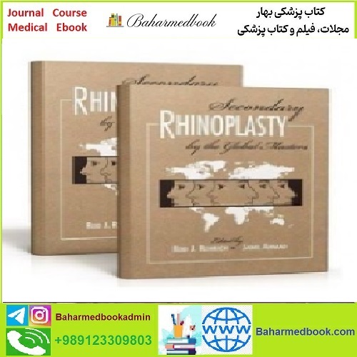 Secondary Rhinoplasty by the Global Masters TRUE PDF price 1€ - کتاب پزشکی بهار