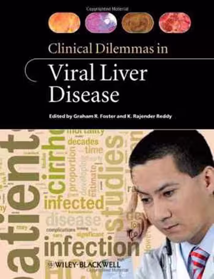 [PDF] دانلود کتاب Clinical Dilemmas In Viral Liver Disease, 2010