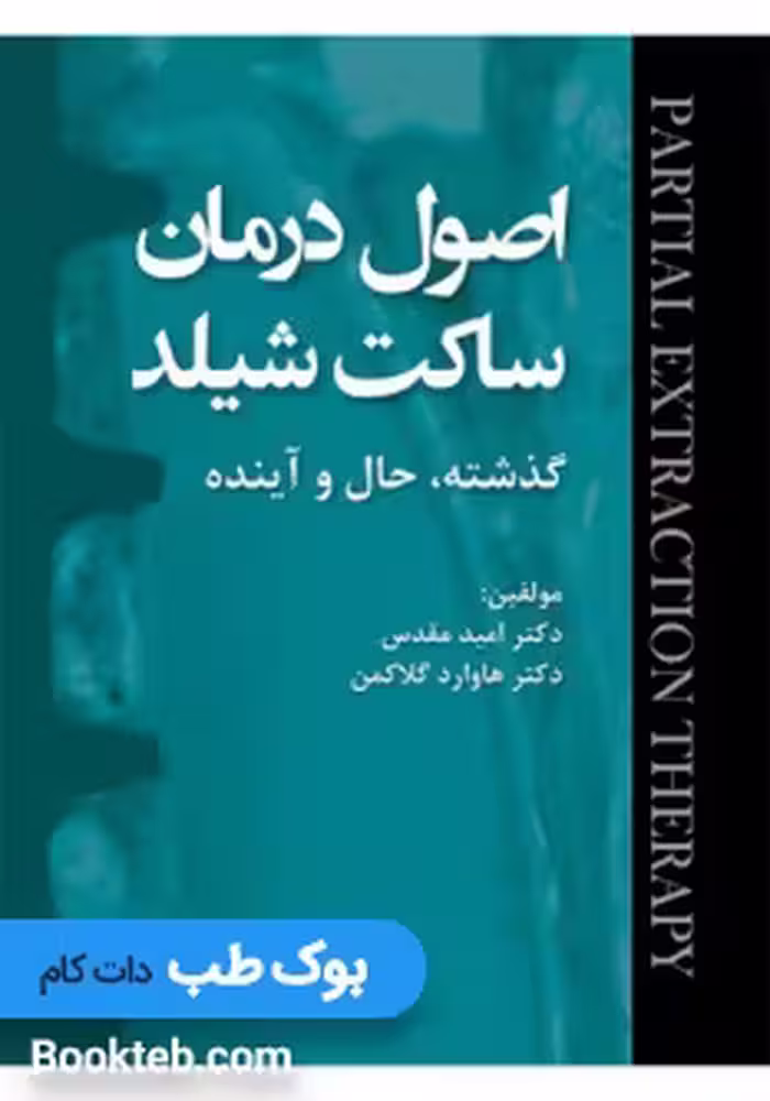 اصول درمان ساکت شیلد؛ گذشته، حال و آینده