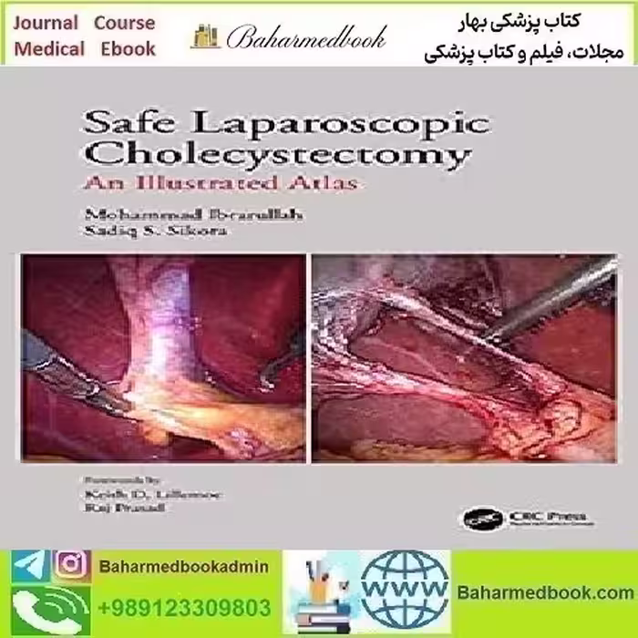Safe Laparoscopic Cholecystectomy An Illustrated Atlas
