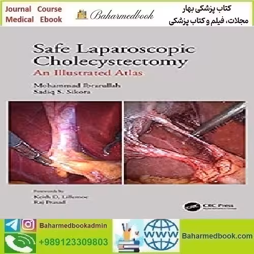 Safe Laparoscopic Cholecystectomy An Illustrated Atlas