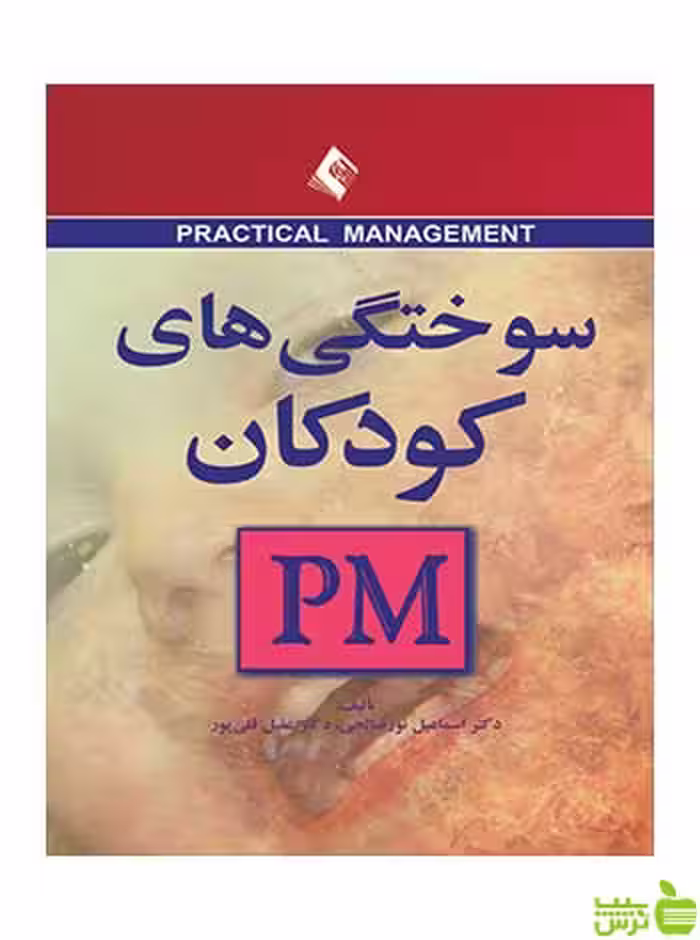 سوختگی های کودکان PM اسماعیل نور صالحی ارجمند - سیب ترش - SibTorsh