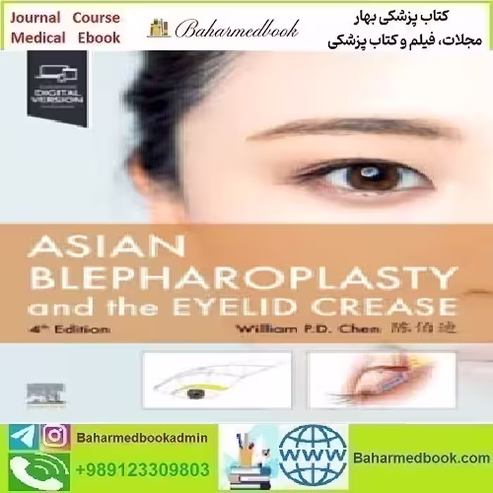 Asian Blepharoplasty and the Eyelid Crease 4th Edition   Video
