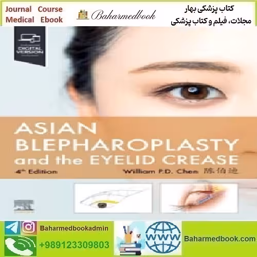 Asian Blepharoplasty and the Eyelid Crease 4th Edition   Video