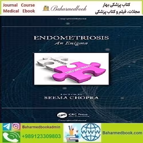 Endometriosis An Enigma 2020 TRUE PDF price 1€ - کتاب پزشکی بهار