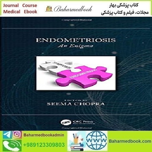 Endometriosis An Enigma 2020 TRUE PDF price 1€ - کتاب پزشکی بهار