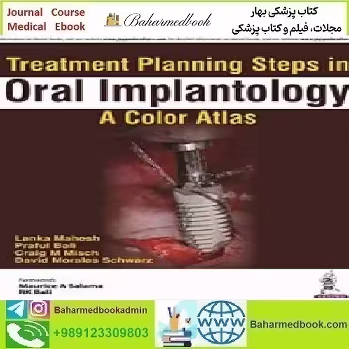 Treatment Planning Steps in Oral Implantology 2018 TRUE