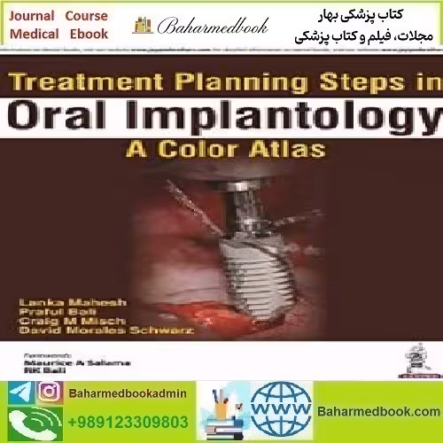 Treatment Planning Steps in Oral Implantology 2018 TRUE