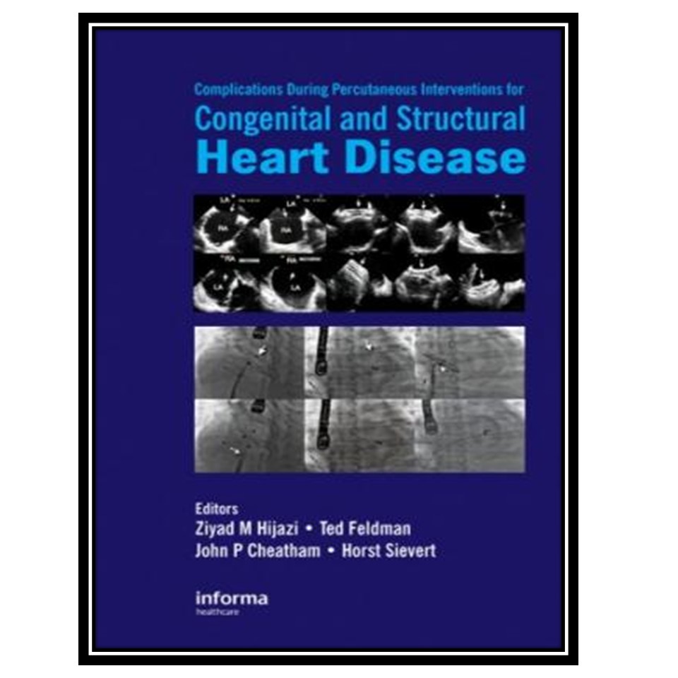 کتاب Complications During Percutaneous Interventions for Congenital and Structural Heart Disease اثر جمعی از نویسندگان انتشارات مؤلفین طلایی
