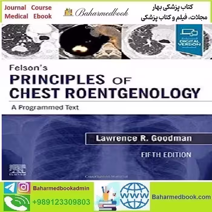 Felson's Principles of Chest Roentgenology TRUE PDF VIDEOS price 2€ - کتاب پزشکی بهار