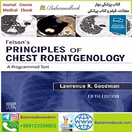 Felson's Principles of Chest Roentgenology TRUE PDF VIDEOS price 2€ - کتاب پزشکی بهار